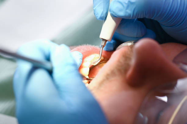 Best Mobile Emergency Dentist in West Tawakoni, TX