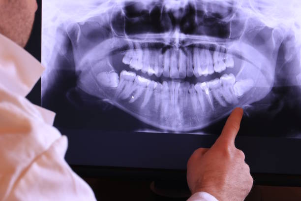 Best Orthodontic Emergency Dentist in West Tawakoni, TX