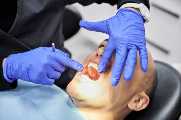 Best Emergency Dentist for Lost Fillings or Crowns in West Tawakoni, TX